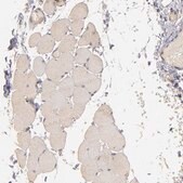 Anti-PRKCD antibody produced in rabbit Ab1, Prestige Antibodies&#174; Powered by Atlas Antibodies, affinity isolated antibody, buffered aqueous glycerol solution
