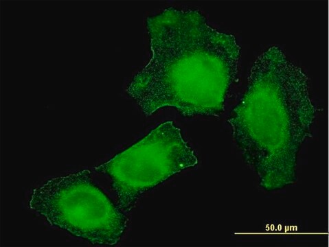 Monoclonal Anti-TIAM2 antibody produced in mouse clone 3C1, purified immunoglobulin, buffered aqueous solution