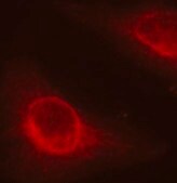 Anti-Phospho-CFL1-S3 antibody produced in rabbit
