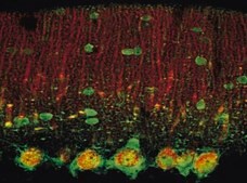 Anti-Calcium Channel Antibody, Voltage Gated &#945; 1C Chemicon&#174;, from rabbit