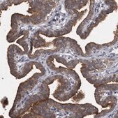 Anti-PRKCI antibody produced in rabbit affinity isolated antibody, buffered aqueous glycerol solution