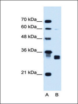 Anti-CBR1 antibody produced in rabbit IgG fraction of antiserum