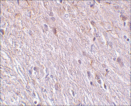 Anti-TTC5 antibody produced in rabbit affinity isolated antibody, buffered aqueous solution