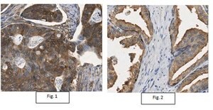 Anti-LDHB Antibody from rabbit, purified by affinity chromatography