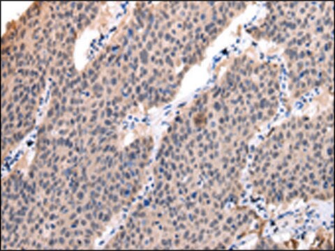 Anti-POLR2K affinity isolated antibody