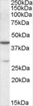 Anti-CBX8 antibody produced in goat affinity isolated antibody, buffered aqueous solution