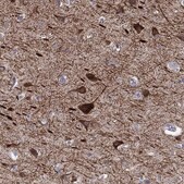 Anti-KCNH1 antibody produced in rabbit Prestige Antibodies&#174; Powered by Atlas Antibodies, affinity isolated antibody, buffered aqueous glycerol solution