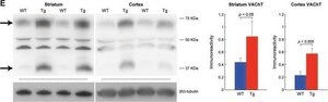 Anti-&#946;-Tubulin III (neuronal) antibody, Mouse monoclonal ~1.0&#160;mg/mL, clone 2G10, purified from hybridoma cell culture