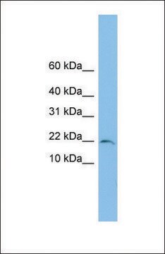 Anti-TRAPPC1 antibody produced in rabbit affinity isolated antibody
