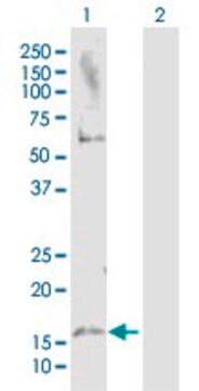 Anti-MAP1LC3A antibody produced in rabbit purified immunoglobulin, buffered aqueous solution