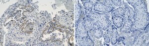 Anti-Laminin-5 Antibody, clone 1D3 ZooMAb&#174; Rabbit Monoclonal recombinant, expressed in HEK 293 cells
