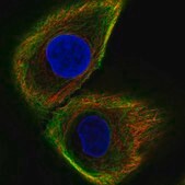Anti-KRT17 antibody produced in rabbit Ab1, Prestige Antibodies&#174; Powered by Atlas Antibodies, affinity isolated antibody, buffered aqueous glycerol solution