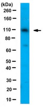 Anti-E6AP Antibody serum, from rabbit