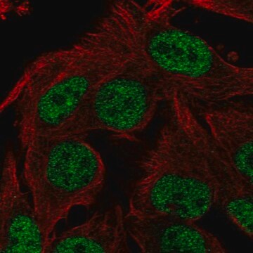 Anti-ST6GALNAC3 antibody produced in rabbit Prestige Antibodies&#174; Powered by Atlas Antibodies, affinity isolated antibody