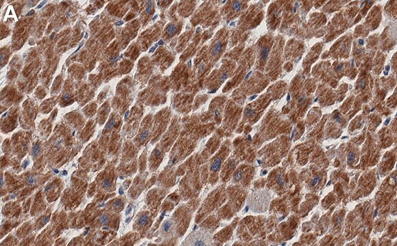 Anti-NDUFB8 Antibody, clone 1E7 ZooMAb&#174; Rabbit Monoclonal recombinant, expressed in HEK 293 cells