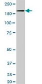 Anti-NID1 antibody produced in mouse IgG fraction of antiserum, buffered aqueous solution