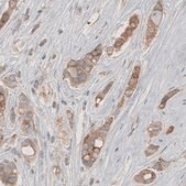 Monoclonal Anti-HMGCR antibody produced in mouse Prestige Antibodies&#174; Powered by Atlas Antibodies, clone CL0259, purified immunoglobulin, buffered aqueous glycerol solution