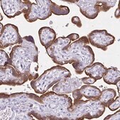 Anti-CYP19A1 antibody produced in rabbit Prestige Antibodies&#174; Powered by Atlas Antibodies, affinity isolated antibody, buffered aqueous glycerol solution