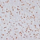 Anti-Phospho-CHEK1-S280 antibody produced in rabbit