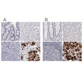 Anti-CA6 antibody produced in rabbit Prestige Antibodies&#174; Powered by Atlas Antibodies, affinity isolated antibody, buffered aqueous glycerol solution, ab1