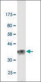 Monoclonal Anti-LAMA2, (C-terminal) antibody produced in mouse clone 1A7, purified immunoglobulin, buffered aqueous solution