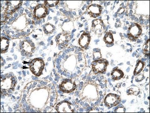 Anti-FOXF2 antibody produced in rabbit IgG fraction of antiserum