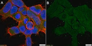 Anti-CaM Kinase II β Antibody, clone 1F13 ZooMAb&#174; Rabbit Monoclonal recombinant, expressed in HEK 293 cells