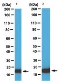 Anti-Fatty-acid binding protein 5 Antibody from rabbit