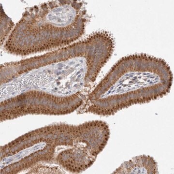 Anti-NPC1 antibody produced in rabbit Prestige Antibodies&#174; Powered by Atlas Antibodies, affinity isolated antibody, buffered aqueous glycerol solution