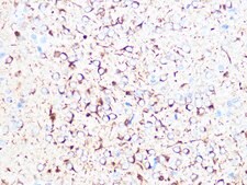 Anti-&#946;II-Tubulin/&#946;2-Tubulin Antibody, clone 1R3R9, Rabbit Monoclonal