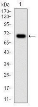 Monoclonal Anti-G6PD antibody produced in mouse clone 5E12, ascites fluid