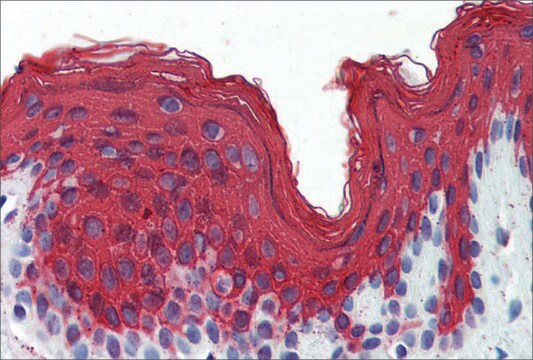 Anti-KRT1 antibody produced in rabbit affinity isolated antibody