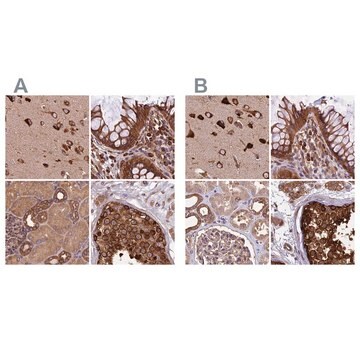 Anti-KARS antibody produced in rabbit Prestige Antibodies&#174; Powered by Atlas Antibodies, affinity isolated antibody, buffered aqueous glycerol solution