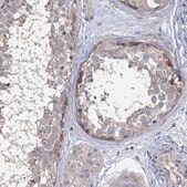 Anti-EPB41L5 antibody produced in rabbit Prestige Antibodies&#174; Powered by Atlas Antibodies, affinity isolated antibody, buffered aqueous glycerol solution