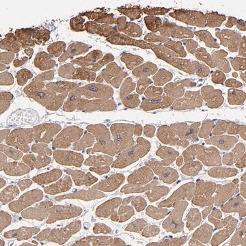 Anti-CCDC80 antibody produced in rabbit Prestige Antibodies&#174; Powered by Atlas Antibodies, affinity isolated antibody, buffered aqueous glycerol solution