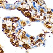 Anti-HBG1 Antibody, clone 6F1A8, Rabbit Monoclonal