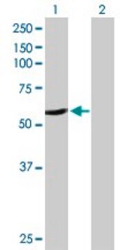 Anti-CYP2A6 antibody produced in rabbit purified immunoglobulin, buffered aqueous solution