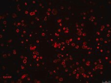 Linia komórkowa CR4 ludzkiego raka jelita grubego CR4 is a unique, cancer stem cell (CSC) enriched, human colorectal cancer cell line useful for CSC-targeted drug development and research focused on cancer cell and CSC biology.