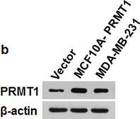 Anti-PRMT1 Antibody Upstate&#174;, from rabbit