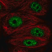 Anti-DDX39B antibody produced in rabbit Prestige Antibodies&#174; Powered by Atlas Antibodies, affinity isolated antibody, buffered aqueous glycerol solution