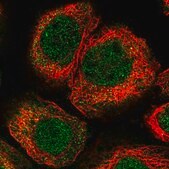 Anti-KLHL7 antibody produced in rabbit Prestige Antibodies&#174; Powered by Atlas Antibodies, affinity isolated antibody, buffered aqueous glycerol solution, ab2
