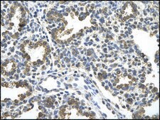 Anti-HDAC9 antibody produced in rabbit IgG fraction of antiserum
