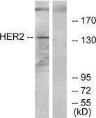 Anti-HER2 antibody produced in rabbit affinity isolated antibody