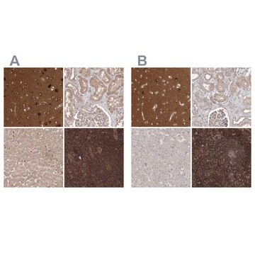 Anti-WDR37 antibody produced in rabbit Prestige Antibodies&#174; Powered by Atlas Antibodies, affinity isolated antibody, buffered aqueous glycerol solution