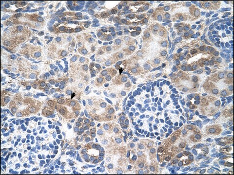 Anti-SLC14A1 antibody produced in rabbit affinity isolated antibody