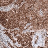 Anti-GSPT1 antibody produced in mouse Prestige Antibodies&#174; Powered by Atlas Antibodies, clone CL13336, purified by using Protein A, buffered aqueous glycerol solution