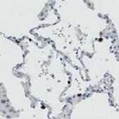 Monoclonal Anti-MMP9 antibody produced in mouse Prestige Antibodies&#174; Powered by Atlas Antibodies, clone CL0538, purified immunoglobulin, buffered aqueous glycerol solution