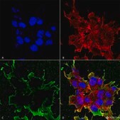 Monoclonal Anti-Tarp antibody produced in mouse clone S245-36, purified immunoglobulin