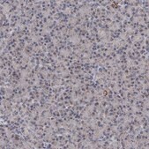Anti-ALDH5A1 antibody produced in rabbit Prestige Antibodies&#174; Powered by Atlas Antibodies, affinity isolated antibody, buffered aqueous glycerol solution, ab2
