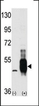 ANTI-COT (MAP3K8/MEKK8)(C-TERMINAL) antibody produced in rabbit IgG fraction of antiserum, buffered aqueous solution